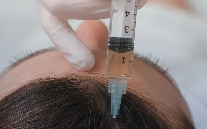beneficios-del-botox-capilar